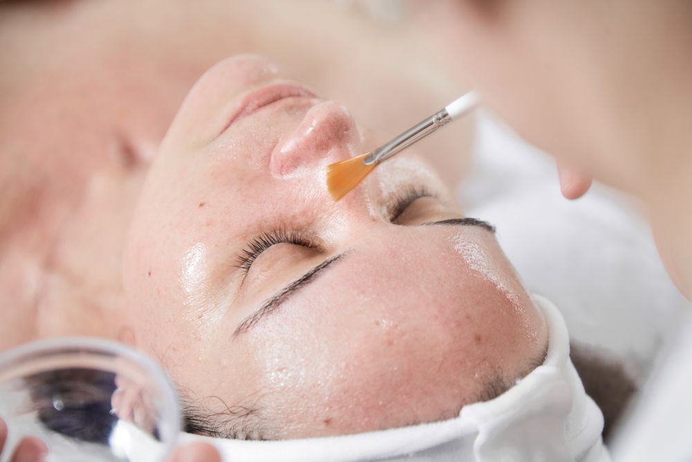 peeling quimico rejuvenecimiento facial